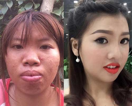 8 ca thẩm mỹ của chị em Việt gây bão dư luận vì "Vịt hóa Thiên Nga"