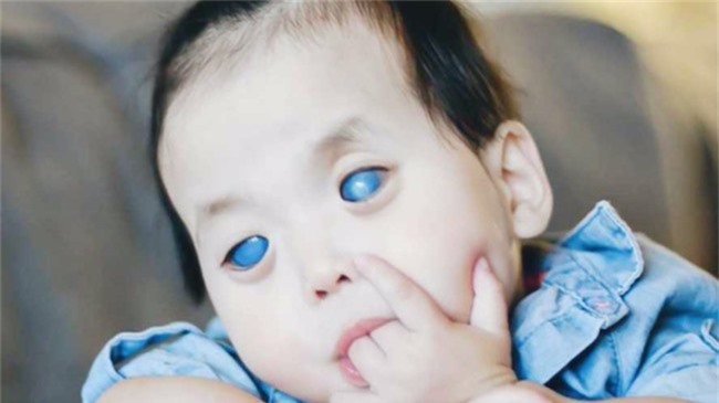 Bé gái có mắt màu xanh bí ẩn và sự thật đau lòng Be gai co mat mau xanh bi an va su that dau long