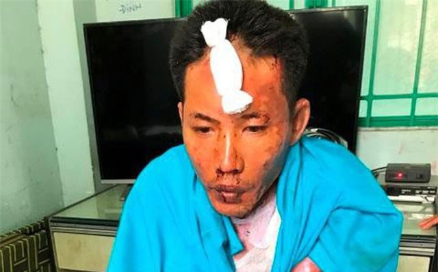 Chồng tưới xăng đốt vợ và 2 con