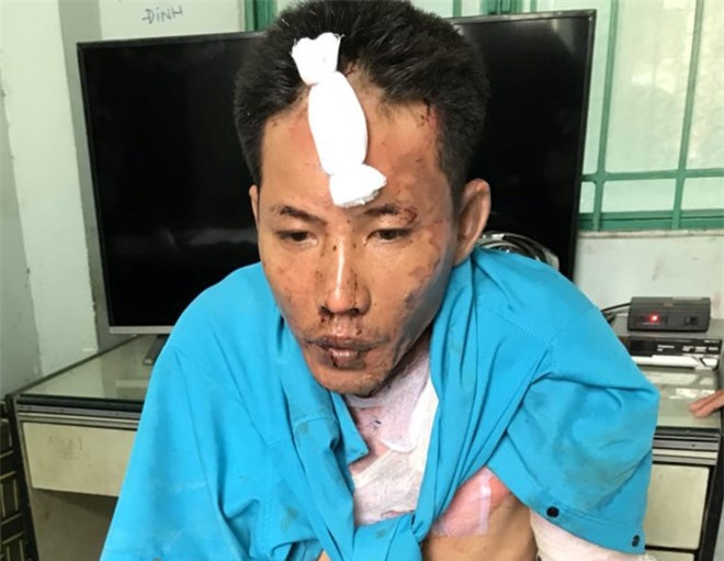 2 cháu bé bị cha dượng dùng xăng đốt đã tử vong