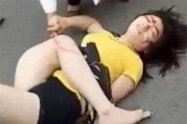 Người phụ nữ bất ngờ ngất xỉu, biến dạng trên đường vì lý do đáng sợ