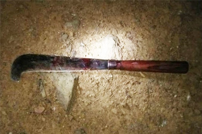 Bắt giữ người chồng vác dao chém đứt 2 bàn tay vợ sắp sinh con