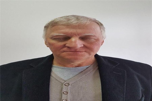 Người đàn ông bạc trắng cả đầu chỉ sau một đêm