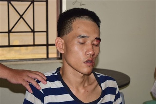 NH&#x1EEE;NG V&#x1EE4; &#xC1;N R&#xDA;NG &#x110;&#x1ED8;NG D&#x1AF; LU&#x1EAC;N TU&#x1EA6;N QUA: Nam thanh ni&#xEA;n gi&#x1EBF;t ng&#x1B0;&#x1EDD;i trong &#x111;&#xE1;m tang cha ru&#x1ED9;t