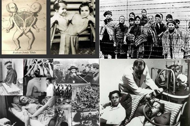 Tội ác kinh hoàng của “bác sĩ quỷ thần” khét tiếng Đức quốc xã