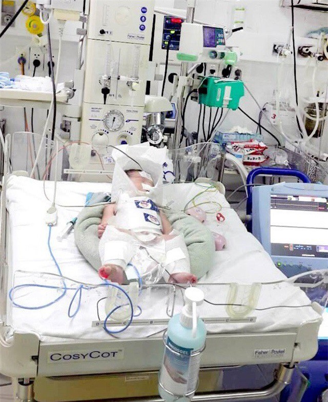 Thai phụ vỡ gan trong phòng chờ sinh