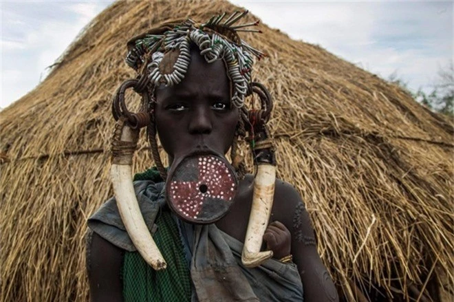 Mursi là một trong hai tộc của người Surma sống dọc sông Omo, miền tây nam Ethiopia. Truyền thống lồng đĩa vào môi dưới là một nét văn hóa đặc trưng ở nơi này.