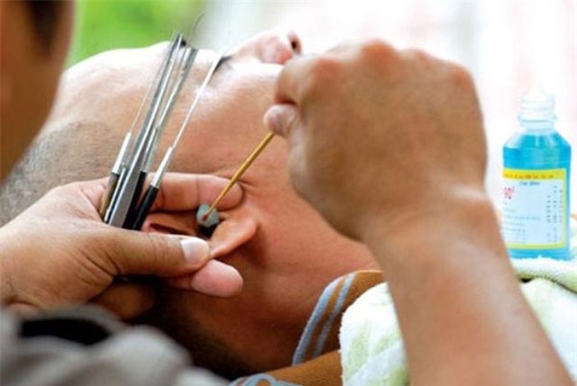 Rước bệnh vì thói quen tỉa lông mũi, lấy ráy tai ngoài hàng