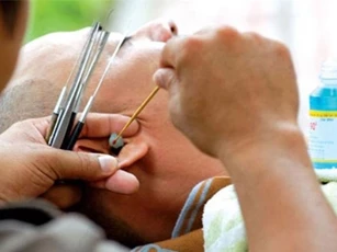 Rước bệnh vì thói quen tỉa lông mũi, lấy ráy tai ngoài hàng