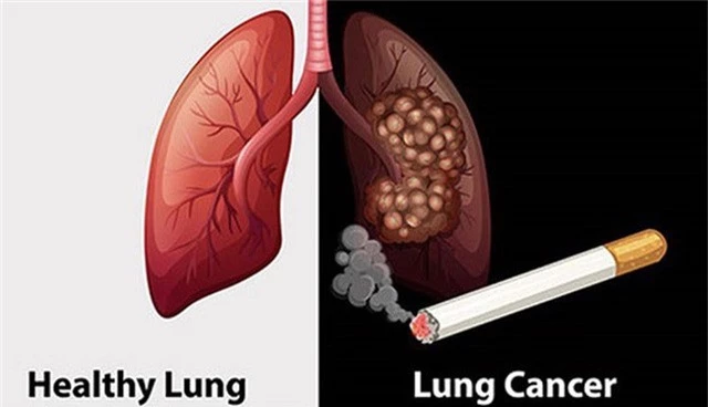 Thói quen có thể gây hại cho các cơ quan đặc biệt của cơ thể - Ảnh 7.