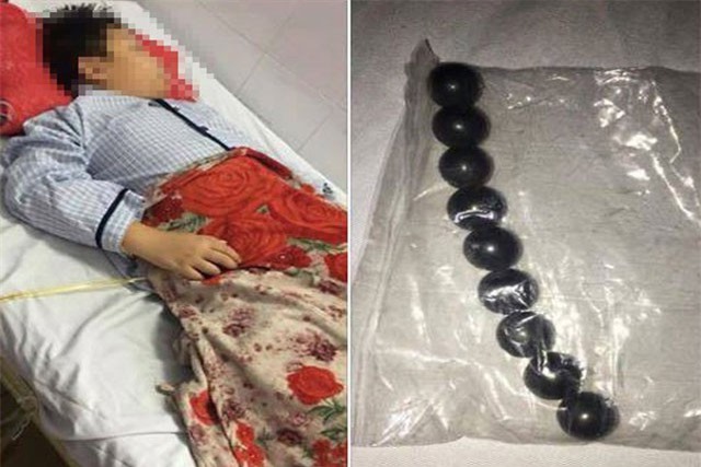 Sẽ làm rõ vụ việc nam sinh lớp 5 bị bạn học ép nuốt 9 viên bi sắt