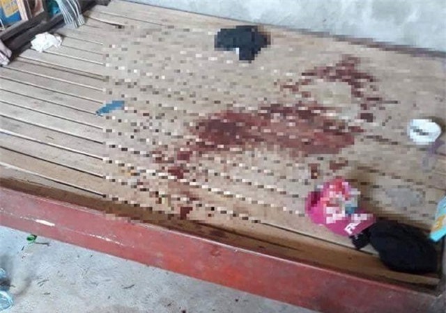 Người cha khai cứa cổ con vì bé gái đòi đi tập văn nghệ