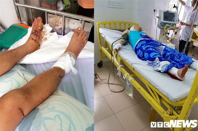 Nam thanh niên bị nhóm côn đồ lái xe tông trực diện, đâm chém giữa phố