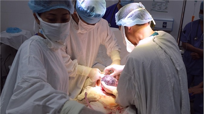 Kỳ tích mẹ suy thận giai đoạn cuối vẫn sinh con khỏe