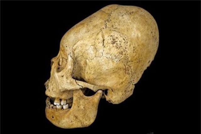Khám phá nguyên nhân khiến các bộ tộc xưa có tập tục làm biến dạng hộp sọ?