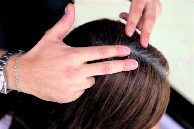 5 nguyên nhân khiến tóc bạc sớm từ năm 20 tuổi mà bạn không hay ngờ tới