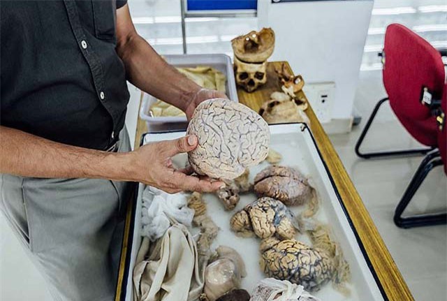 Viện bảo tàng não khiến ai cũng cảm thấy rùng mình khi ghé thăm