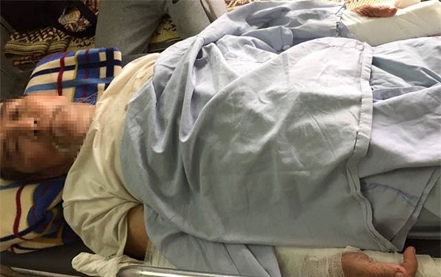 Cụ ông 83 tuổi bị hàng xóm đánh gãy 2 tay vì đi thể dục quá sớm