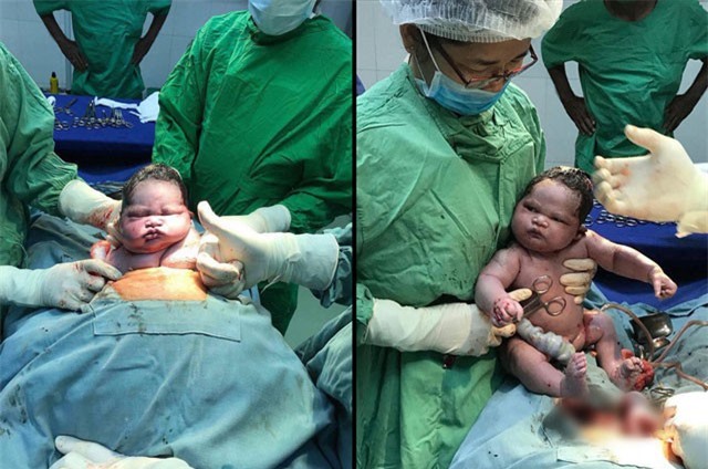 Phì cười với biểu cảm bất ngờ của em bé vừa chào đời