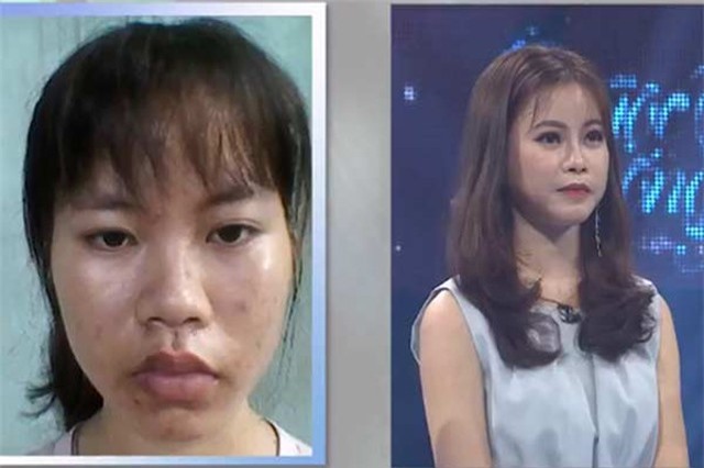 Cô sinh viên y khoa xấu xí trở nên xinh đẹp khiến mẹ không nhận ra