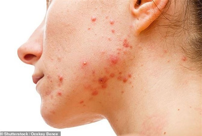 Những dấu hiệu 'lạ' của cơ thể có thể tiết lộ bệnh