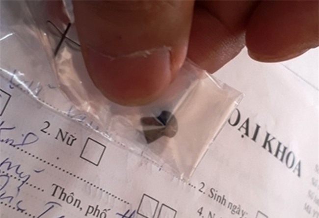 Lâm Đồng: Anh rể thử súng, bắn trúng em vợ