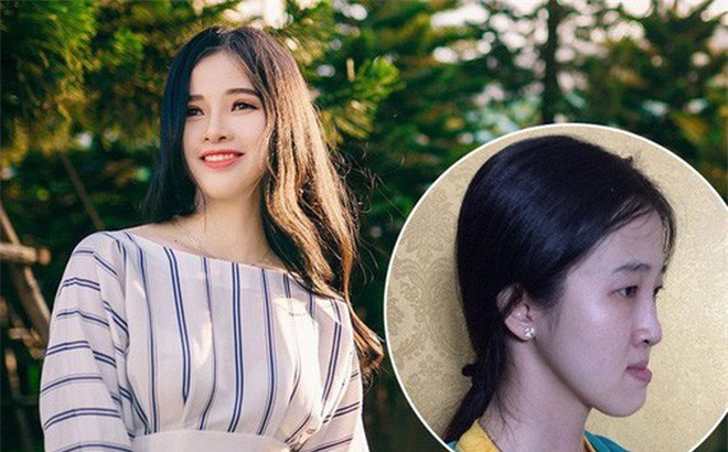 Clip: Sau phẫu thuật thẩm mỹ, cô gái có gương mặt thẳng đuột 'lột xác' đẹp như thiên thần