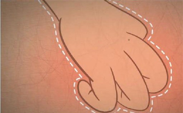 Tại sao gãi ngứa lại dễ chịu đến vậy?