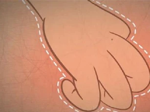 Tại sao gãi ngứa lại dễ chịu đến vậy?