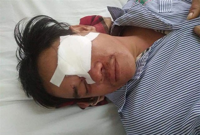 Khởi tố người phụ nữ đâm mù mắt con nợ