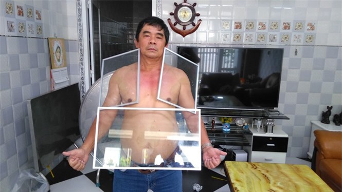 Người đàn ông Tiền Giang 'kỳ lạ' hút kim loại, đá dính chặt người