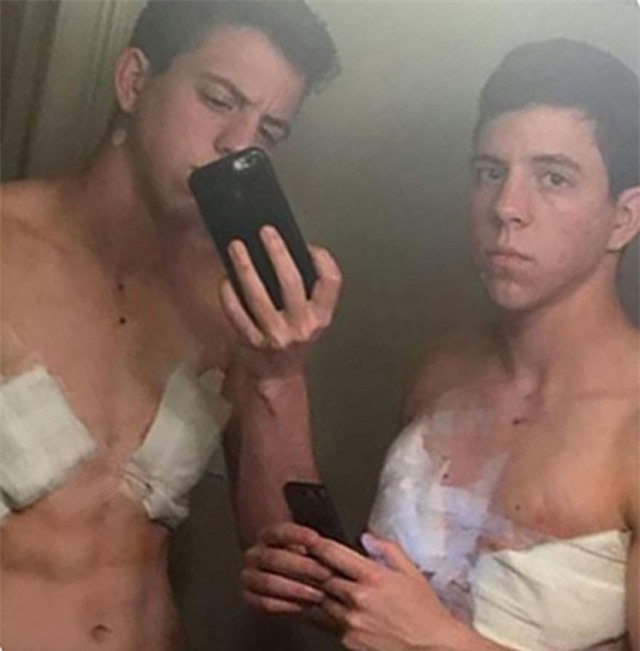 Chị em song sinh rủ nhau chuyển giới