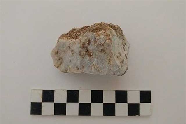 Phát hiện 'đứa bé ma cà rồng' với hòn đá trong miệng