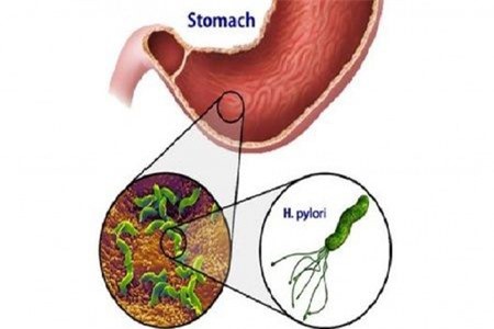 Gắp thức ăn chung “tặng” nhau nguy cơ mắc các bệnh dạ dày