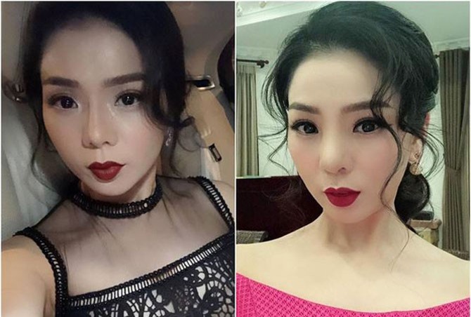 Nguy cơ hoại tử vì sụn mũi, Lệ Quyên nói gì?