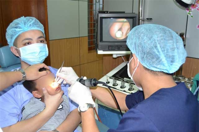 Viên bi nhựa nằm sâu trong hốc mũi của bé trai 4 tuổi