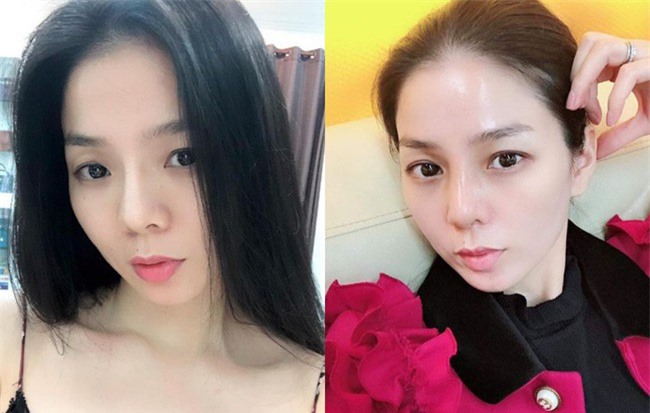 Lệ Quyên vẫn xinh đẹp sau khi tháo sụn mũi