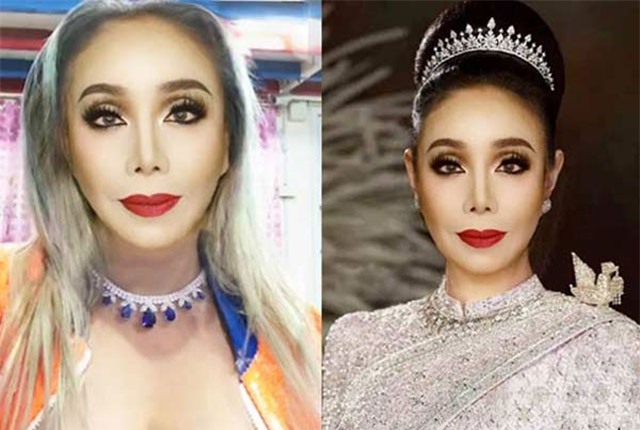 Sự thật ngã ngửa về mặt mới thẩm mỹ của đại gia U60 đòi bồ trẻ "yêu" 28 lần/ngày