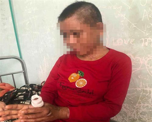 Vụ tra tấn người giúp việc như thời trung cổ: “Nga Vọc” lãnh án 10 năm tù