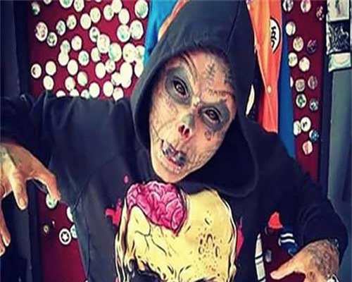 Dị nhân 'hộp sọ sống' tiếp tục gây sốc