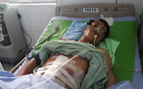 Người đàn ông nhập viện vì súng cướp cò bắn vào bụng