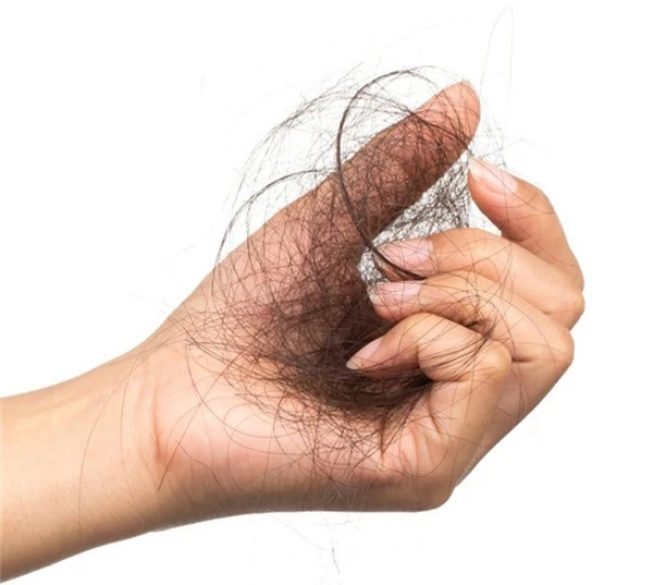 Rụng tóc Tóc rụng quá nhiều có thể là dấu hiệu của rối loạn tuyến giáp, nhiễm trùng da, rối loạn tự miễn dịch.