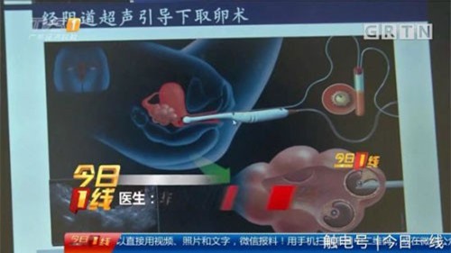 Sự thật đáng sợ phía sau dịch vụ mua bán trứng của các cô gái trẻ