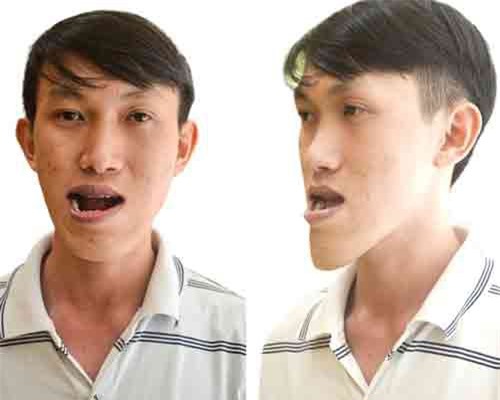 Thạc sĩ 9x khó xin việc, phải chạy xe ôm vì 'mặt dị dạng'