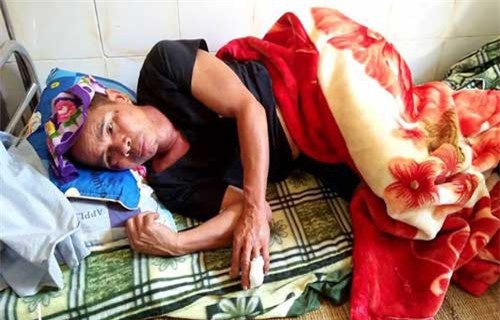 Đi làm rẫy, người đàn ông bị lợn rừng nặng gần 1 tạ tấn công