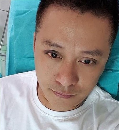 Tuấn Hưng bị bóng đập vào mắt, thị lực còn 4/10