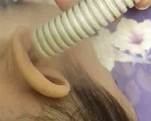 Chữa viêm tai giữa bằng cách thổi sáp ong, mẹ Việt đang hại con