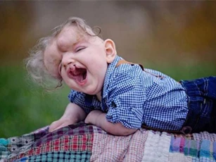 Em bé khuyết sọ đón sinh nhật đầu tiên trong đời