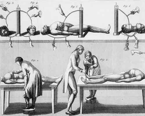 Rợn người thí nghiệm hồi sinh xác chết chấn động lịch sử