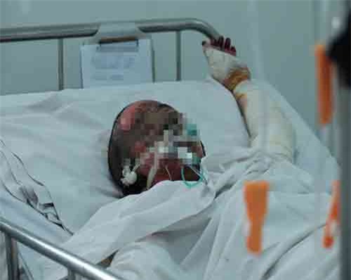 Tạm giữ người chồng tưới xăng đốt vợ